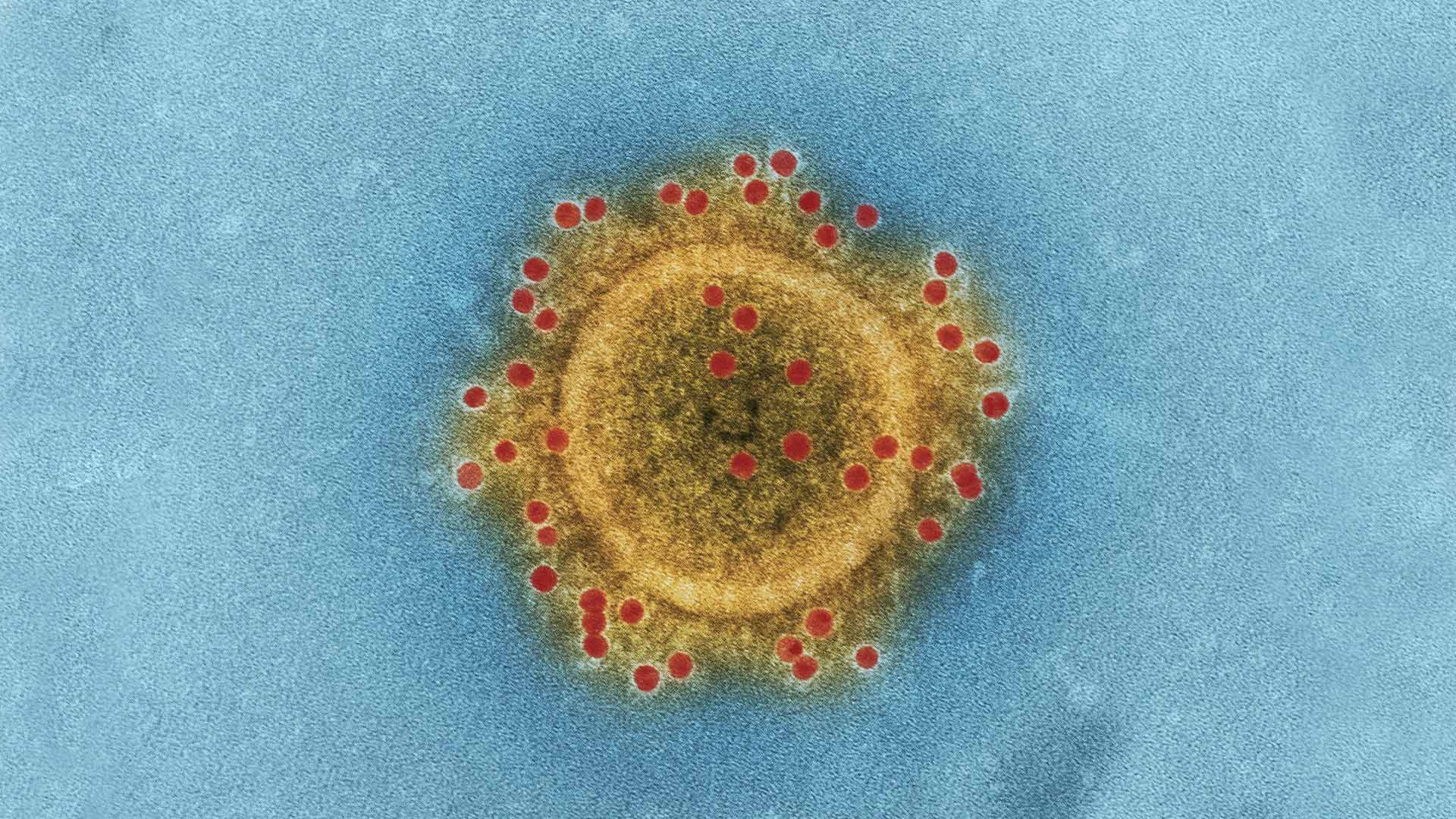 صورة فيروس ميكروسكوبي يثبت أنه أذكى من رافض للقاح لديه ٨٦ مليار عصبون