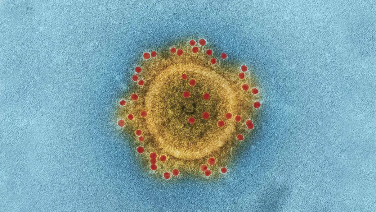 Microscopic virus proves smarter than anti-vaxxer with 86 billion neurons image