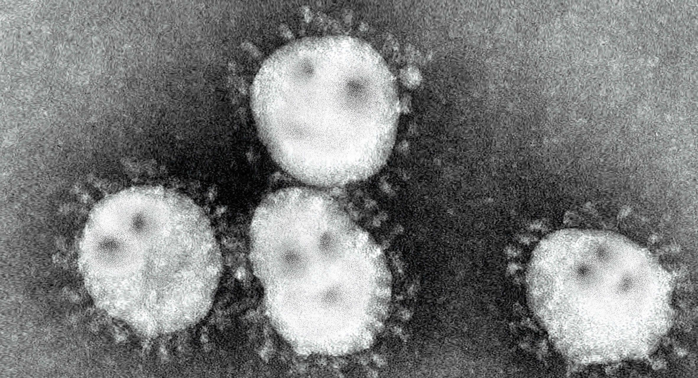صورة تقرير صحفي يؤكد ظهور أربعة فيروسات جديدة ستفتك بك أنت شخصياً خلال ربع ساعة